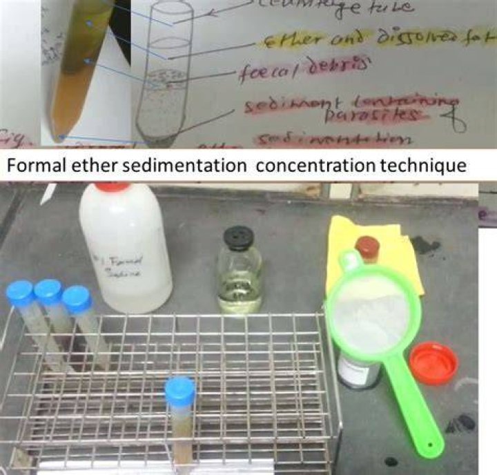 What is concentration technique