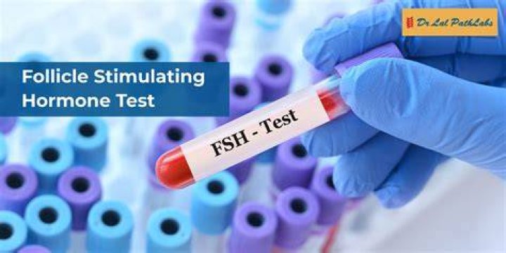 What is follicle stimulating hormone test