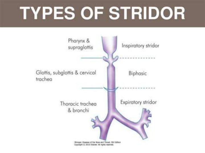 What is inspiratory stridor