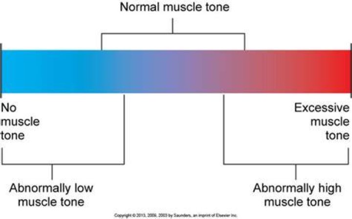 What is muscle tone quizlet