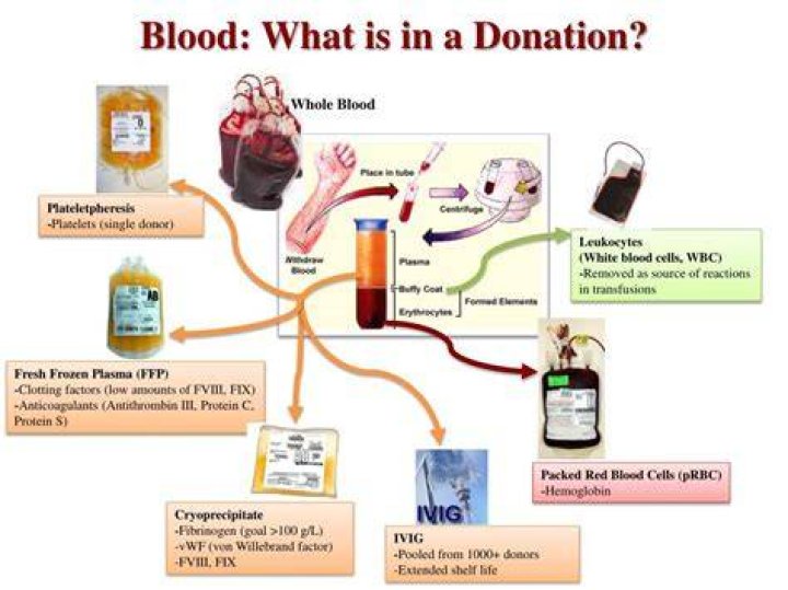 What is Plateletpheresis and when is it done