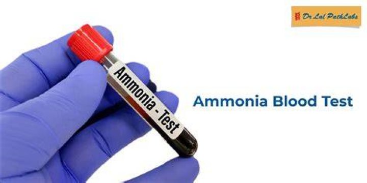 What is serum ammonia