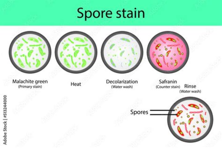 What is Spore staining in microbiology