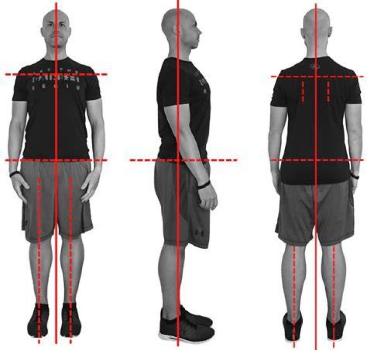 What is static assessment