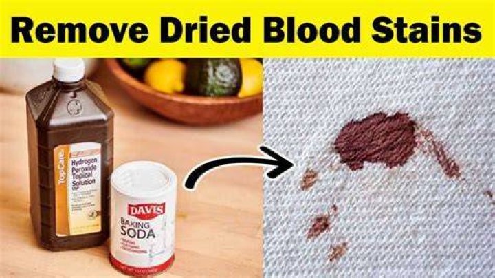What is the best way to remove dried blood
