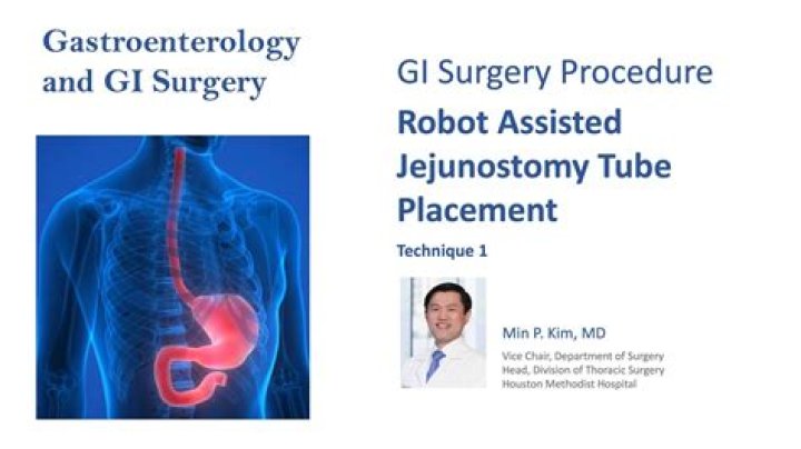What is the CPT code for placement of jejunostomy tube