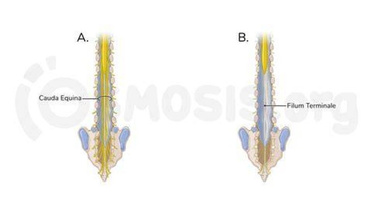 What is the difference between the cauda equina and the filum terminale