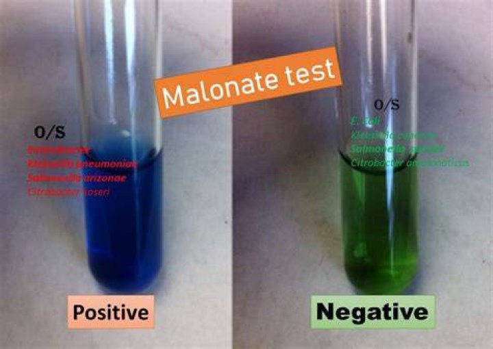 What is the indicator for the malonate utilization test