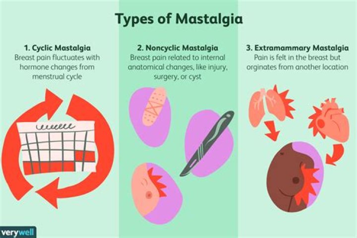What is the meaning of Mastalgia