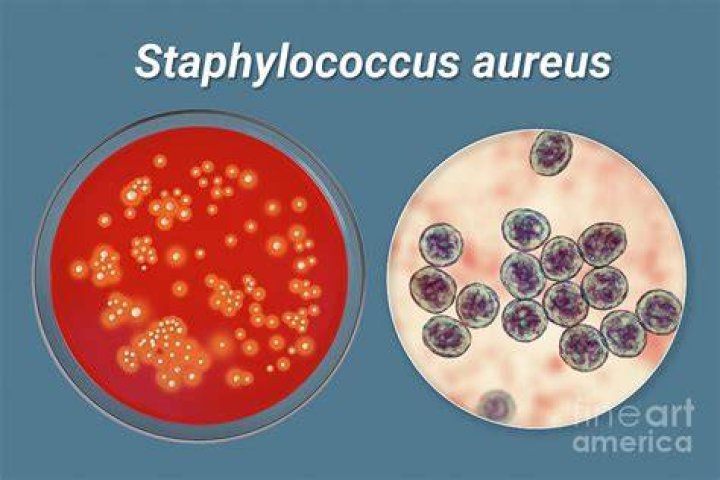 What is the size of Staphylococcus aureus