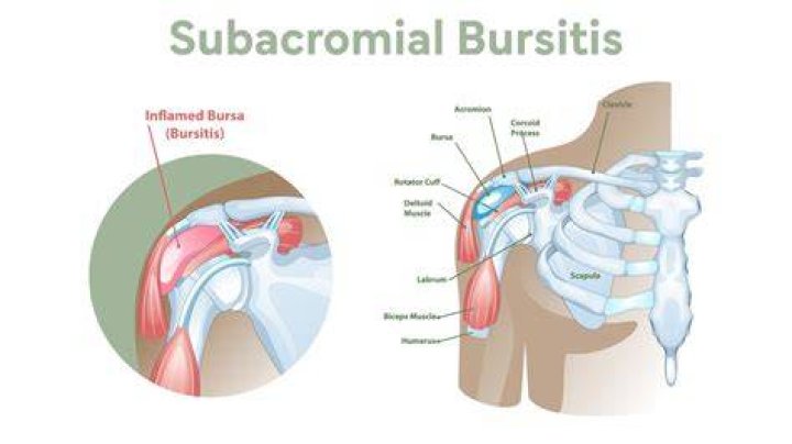 What is the subacromial Subdeltoid Bursa