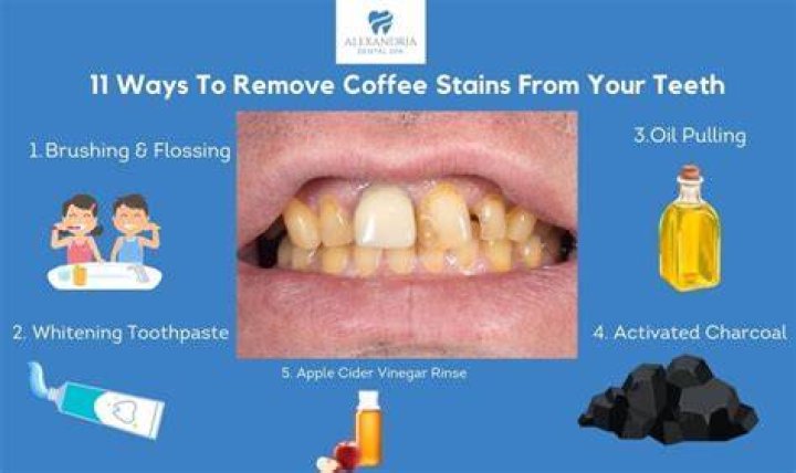 What toothpaste is best to remove stains