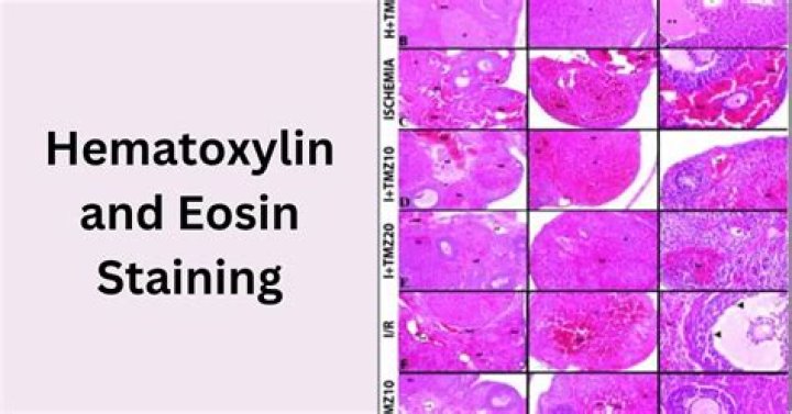 What type of stain is hematoxylin