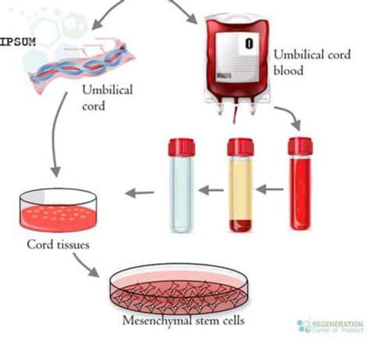 Why are stem cells collected