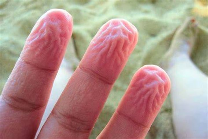 Why does your skin get pruney in water