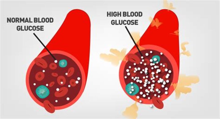 Why is hyperglycemia bad
